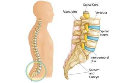 Spondylolisthesis