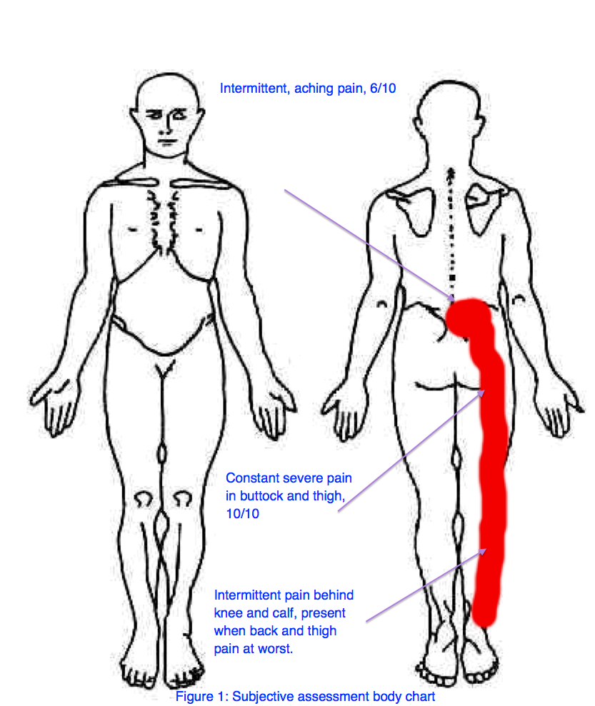 Slip Disc treatment by Dr Devashishs Sharma